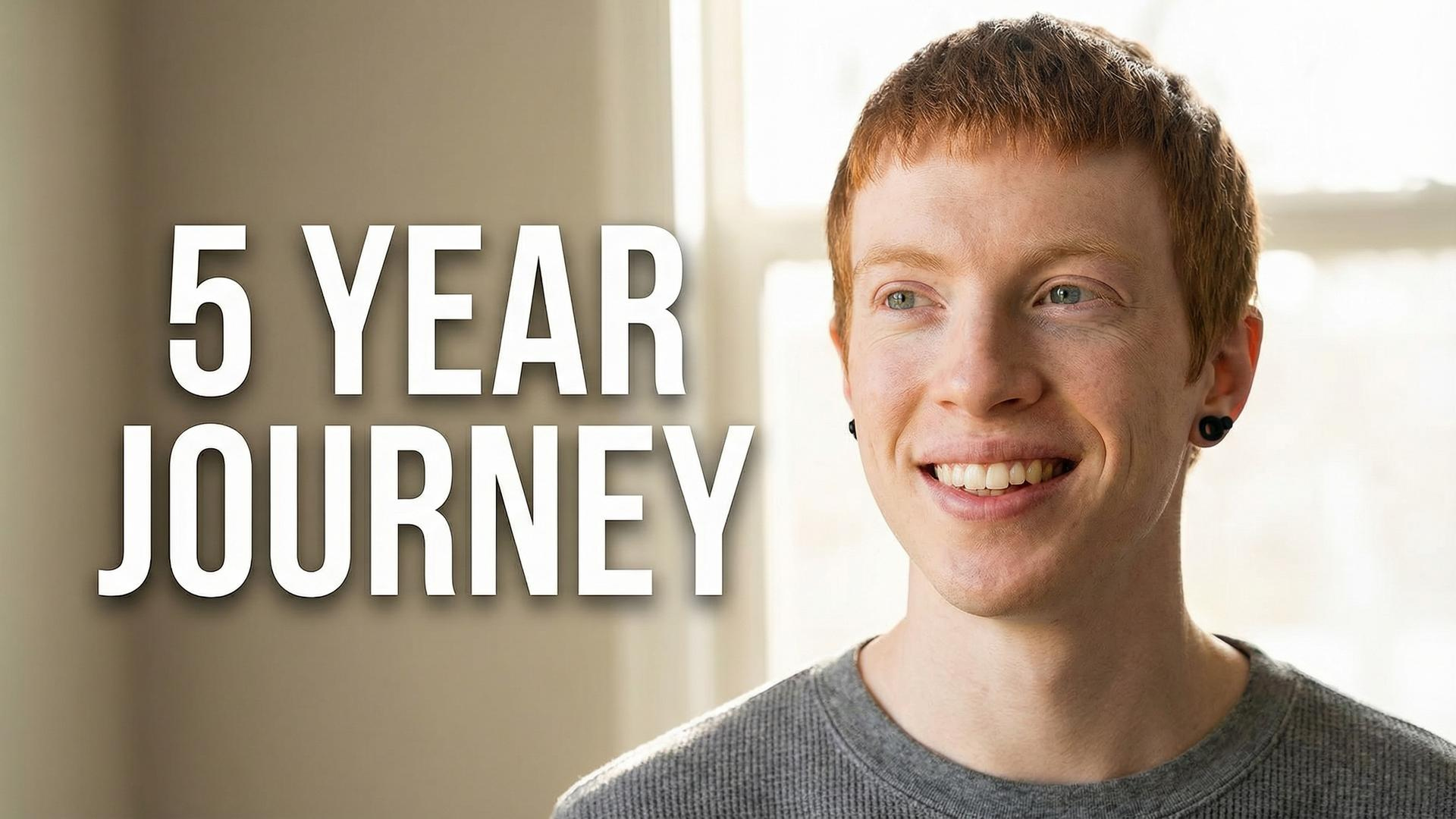 Amazing 5 Year Journey Of A Transgender Man