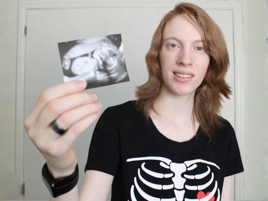 Transgender Pregnancy and Ultrasound